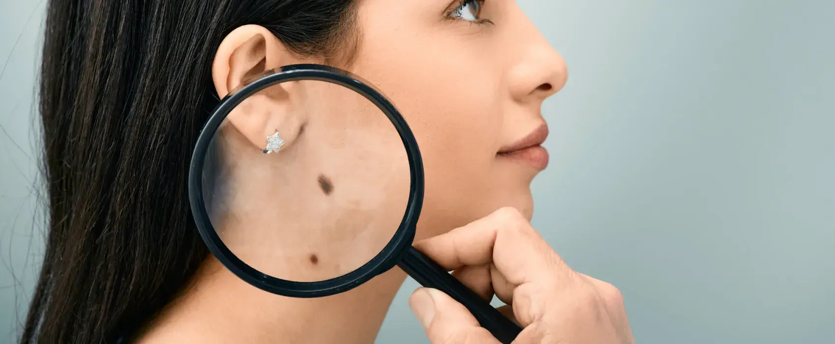Magnifier on mole