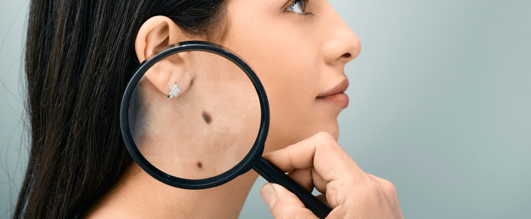 Magnifier on mole
