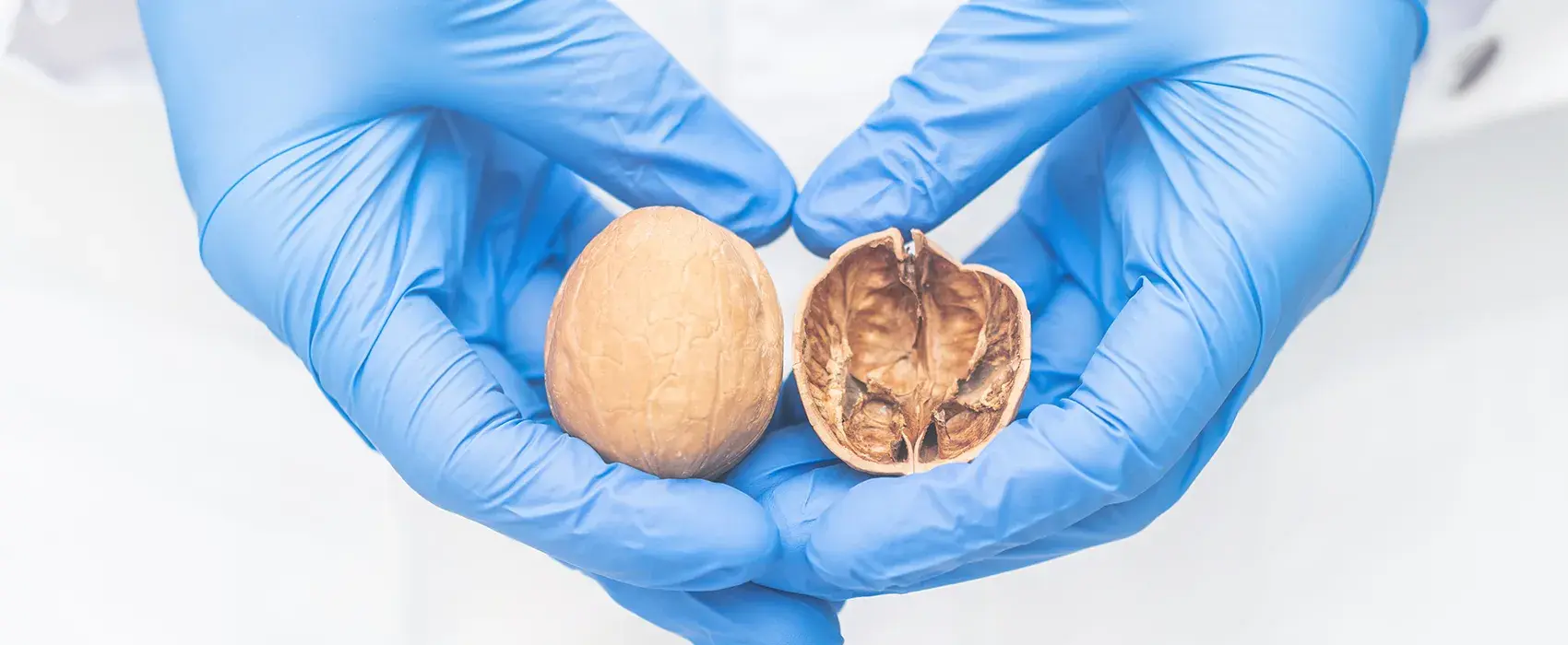 Testicular Cancer